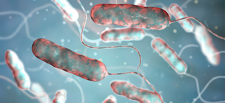 Getting-A-Legionella-Risk-Assessment